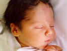 James IN hospital 2.